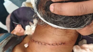 Photo of गावाकडे परततांना वडगाव(वान) जवळ नायलॉन मांज्याने चिरला गळा! युवक गंभीर जखमी…